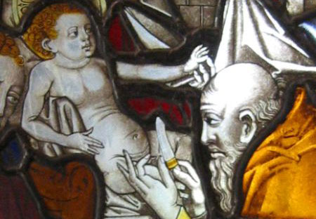 QC FYI: Circumcision Protects Against HIV