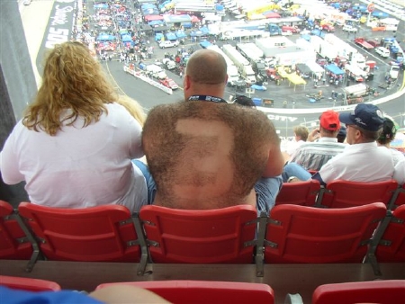 Back Hair Topiary