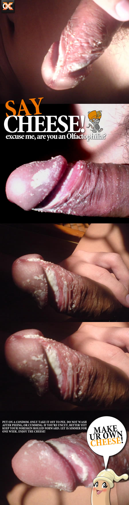 Smegma aka Dick Cheese!