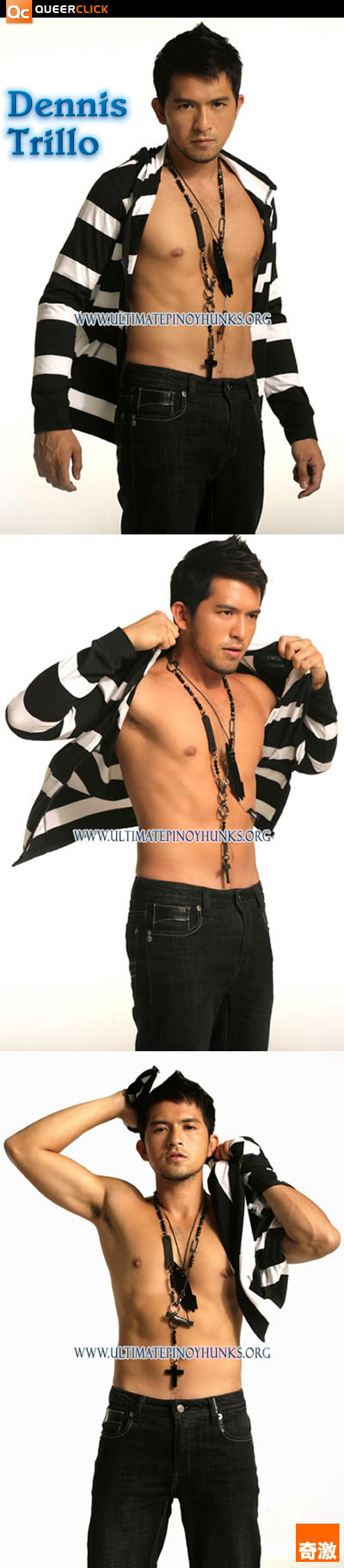 Dennis Trillo is Topless