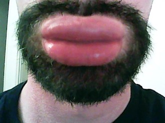mybiglips_1.jpg