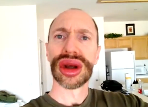 mybiglips_5.png