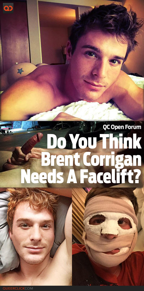 QC Open Forum: Do You Think Brent Corrigan Needs A Facelift?