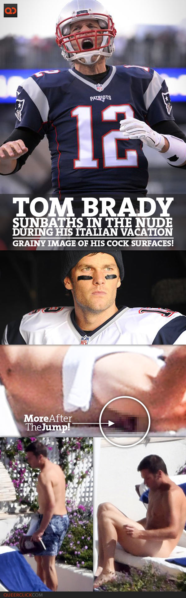 Tom Brady Sunbaths In The Nude During His Italian Vacation - Grainy Image Of His Cock Surfaces!
