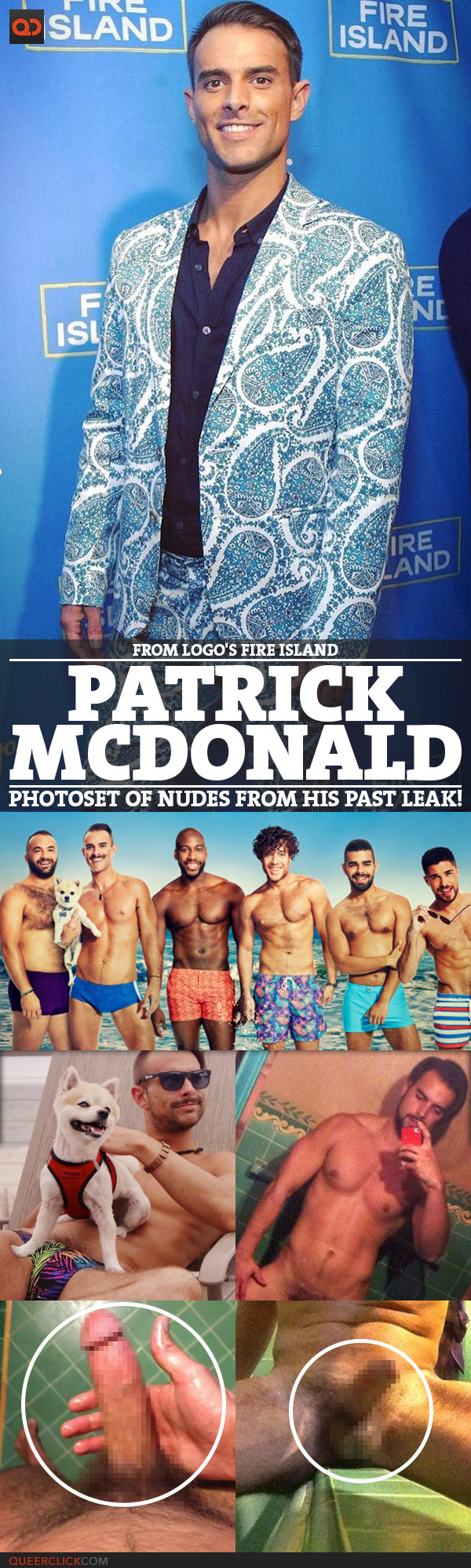 Patrick McDonald, From Logo's Fire Island, PhotoSet Of Nudes From His Past Leak!