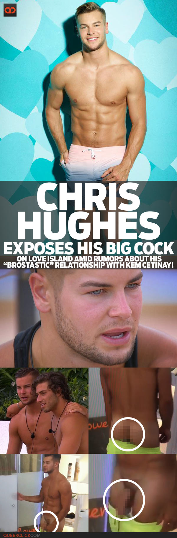 Chris Hughes Exposes His Big Cock On Love Island Amid Rumors About His “Brostastic” Relationship With Kem Cetinay!