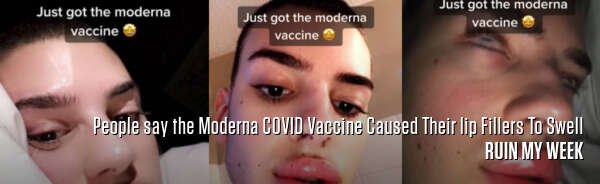 People say the Moderna COVID Vaccine Caused Their lip Fillers To Swell